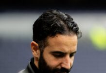 Manchester United hat ein großes Dilemma